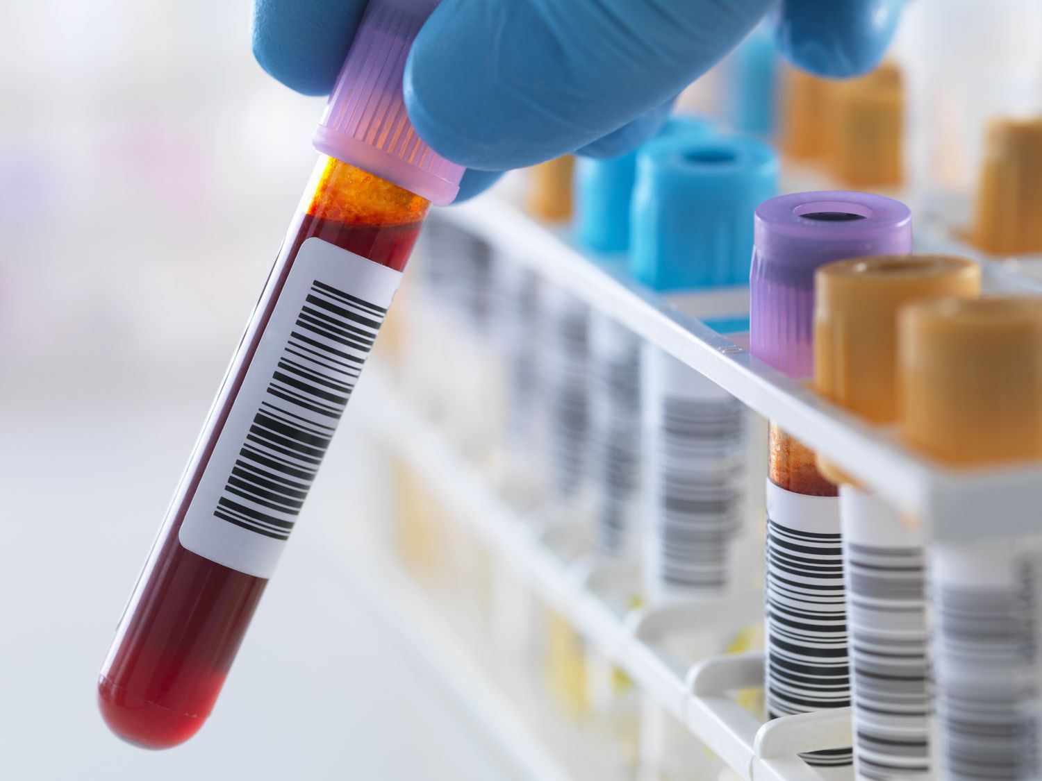 Advanced biomarker blood testing and comprehensive lab analysis at Pravida Health